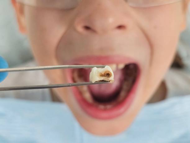 Best Emergency Treatment for Jaw Pain or Injury in Centreville, AL